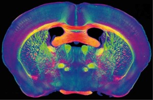 1.12316_2013-01-14_Mouse_Brain_Section