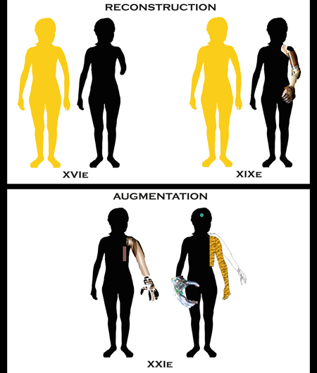 Augmentation 