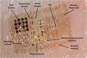 EpidermalElectronicS1